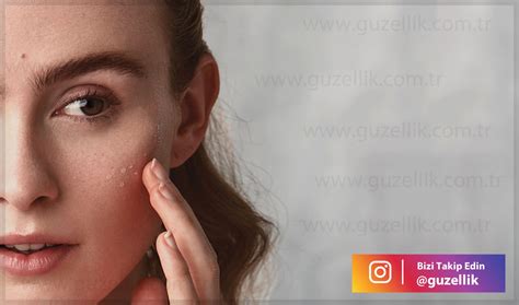Burun Ameliyatı Ödem Attırıcı Yiyecekle Burun Ameliyatı Ödem Attırıcı Yiyecekle