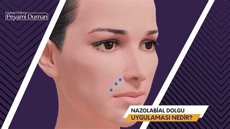 Dolgu Uygulaması Sıkça Sorulan Sorular Dolgu Uygulaması Sıkça Sorulan Sorular