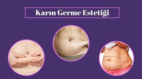 Karın Germe Sonuçlar ve Beklentiler Karın Germe Sonuçlar ve Beklentiler